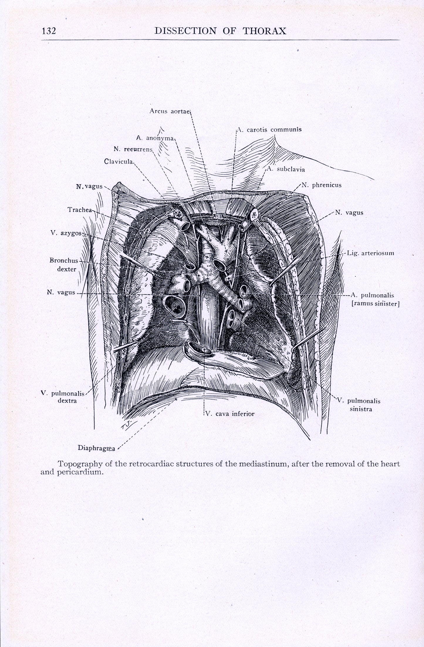 Dissection of Thorax - Print - Stomping Grounds